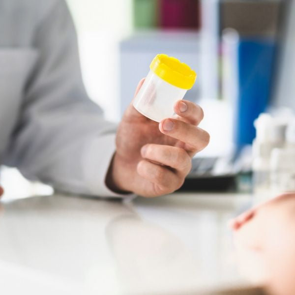 How Random Drug Testing Works