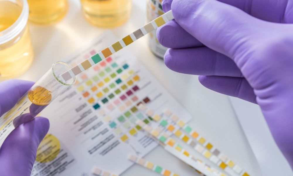 The Importance of Random Drug Testing in College Sports